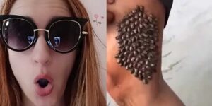 Bacağında çıkanlara inanamadı ve çıkarmaya başladı