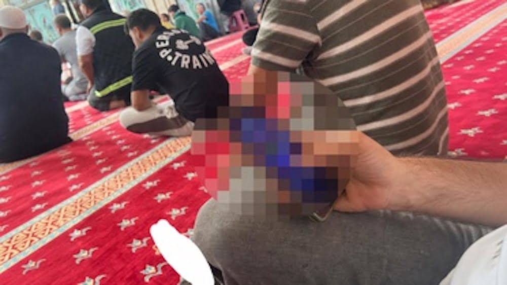 Caminin İçindeki Görüntüler Tepki Çekti! Bakın Ne Yaptı